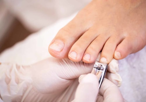 The Truth About Cutting Toenails: How Long Can You Go Without It?