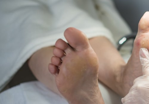 Navigating Medicare Coverage for Routine Foot Care