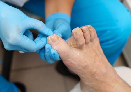 The Cost of Toenail Cutting: What You Need to Know